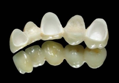 Dental Cad Cam Wieland Lava Cercon Zirconia All Ceramic Aesthetic Crown And Bridge