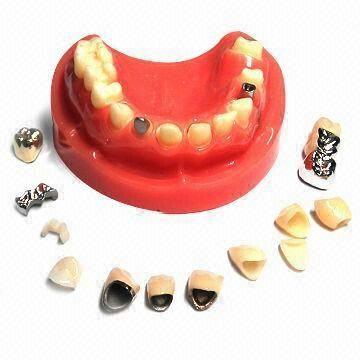 Dental Samples Zirconia Pfm Inlay Fmc Captet Glod Emax