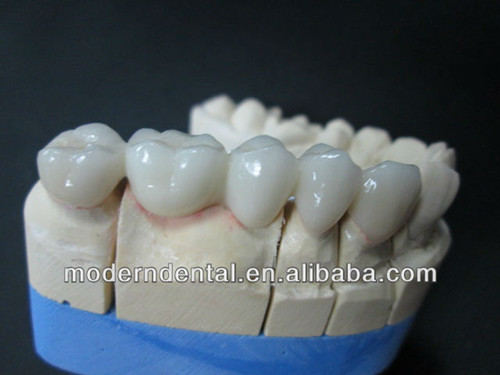 Dental Zirconia Crowns Or Veneers