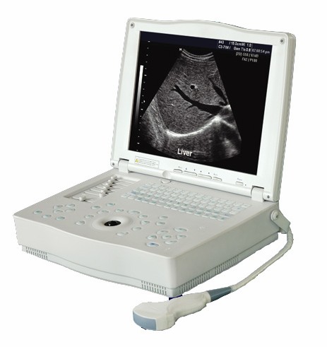 Kr 1000 Laptop Digital Ultrasound Scanner