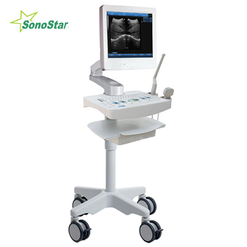 Ss 100 Touch Screen Trolley Ultrasound Diagnosis B Scanner