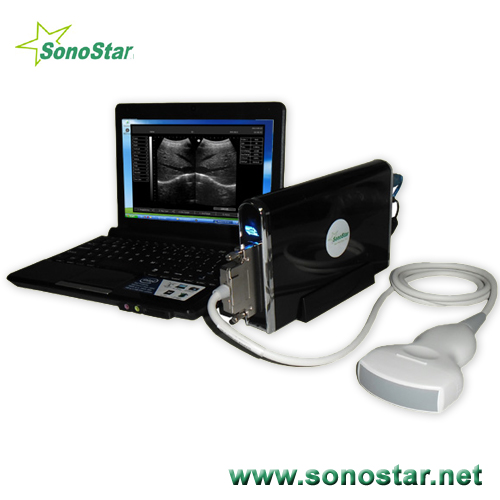 Ubox 9 Ultrasound B Scanner Box Ultrasoni Black White