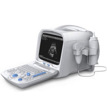 Ultrasound Scanner Portable Md3100