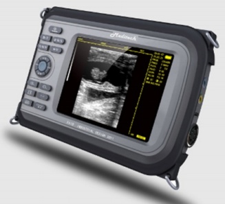 Ultrasound Scanner Portable Sono R