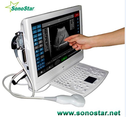 Utouch 8 Touch Screen Lcd Ultrasound Scanner Ultrasoni Black White