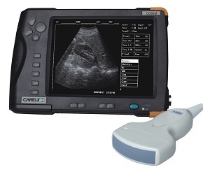 7 Digital Ultrasound Scanner Cd66m
