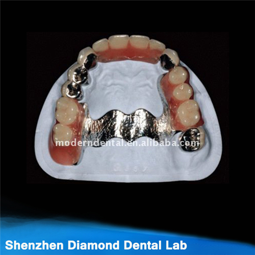 Dental Casting Metal Framework
