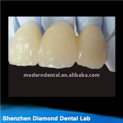 Dental Zirconia Crowns