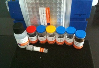 Human Glucose Dependent Insulin Releasing Polypeptide Gip Elisa Kit